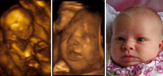 Testimonials Meet The Baby 3D 4D HD Ultrasound.