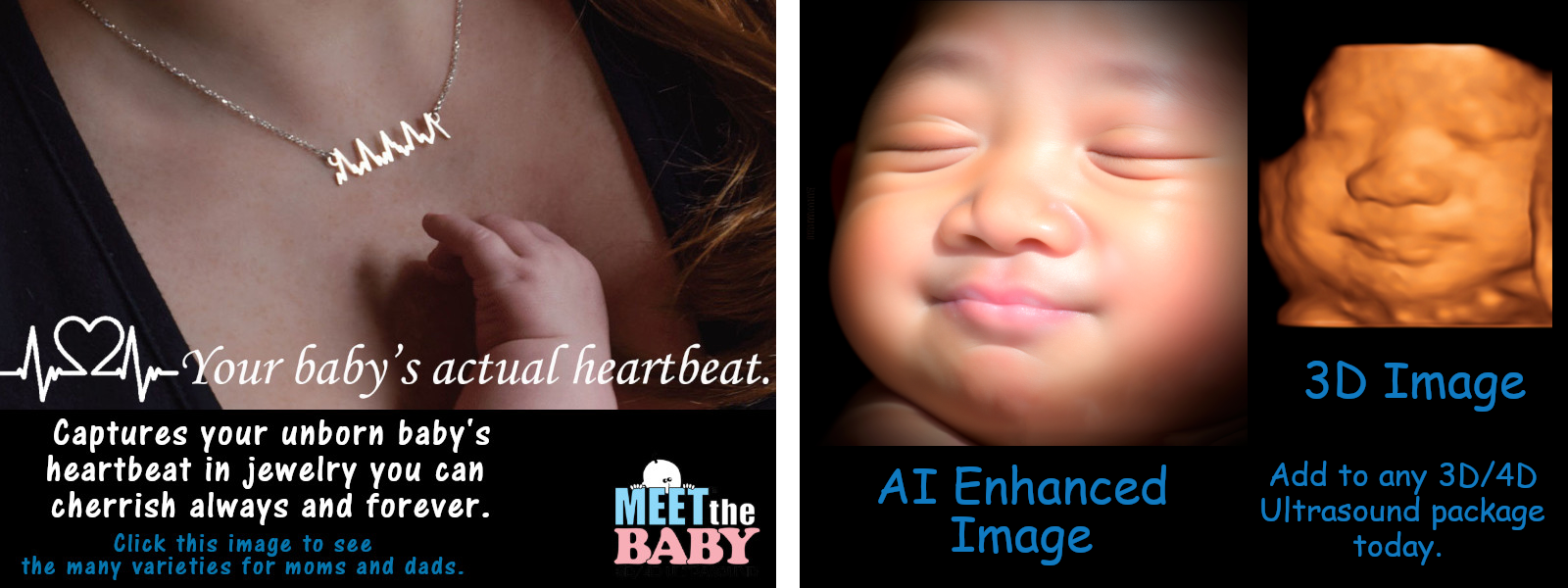 AI enhanced ultrasound image and heartbeat jewelry 